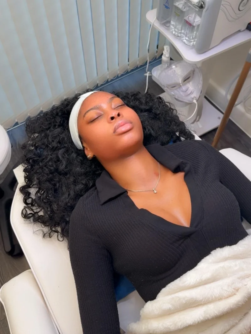Aesthetics treatment result at Pure Drip Aesthetics Snow Hill Birmingham