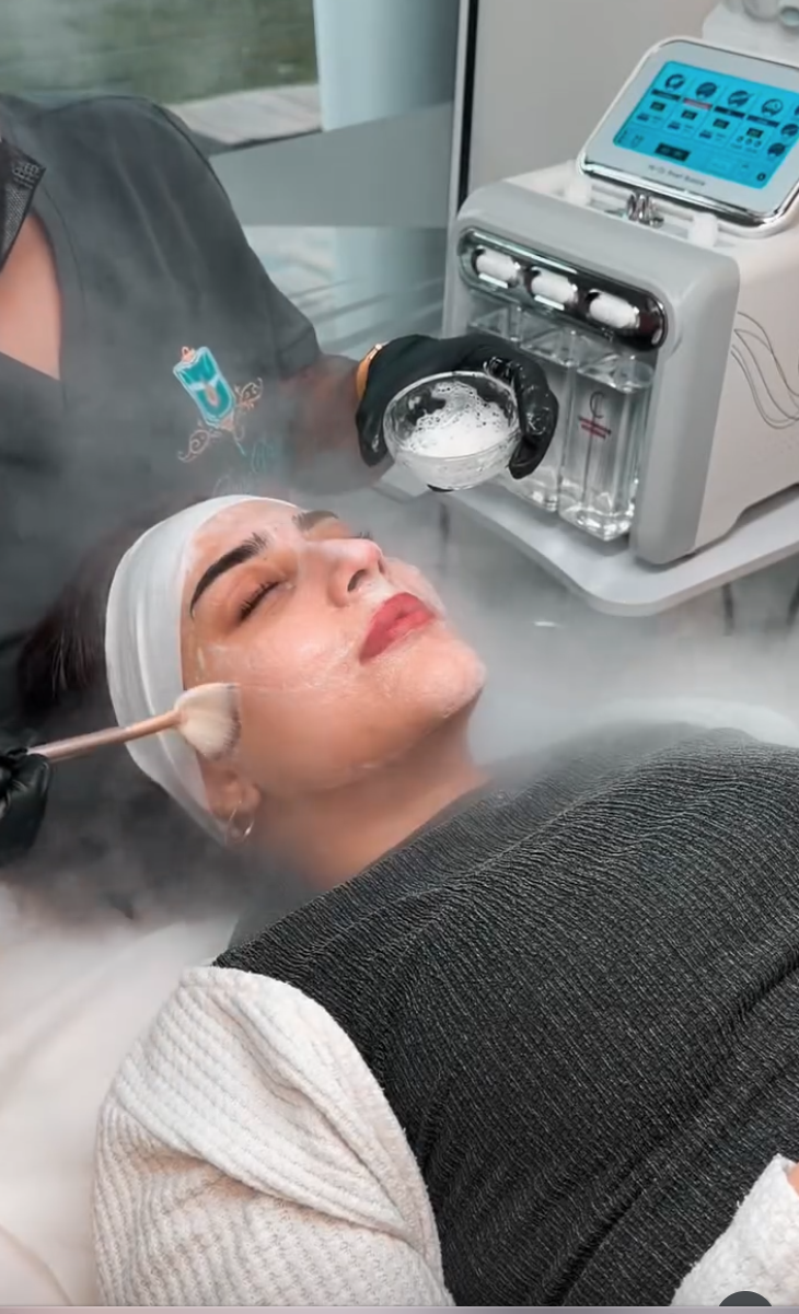 Aesthetics treatment result at Pure Drip Aesthetics Snow Hill Birmingham